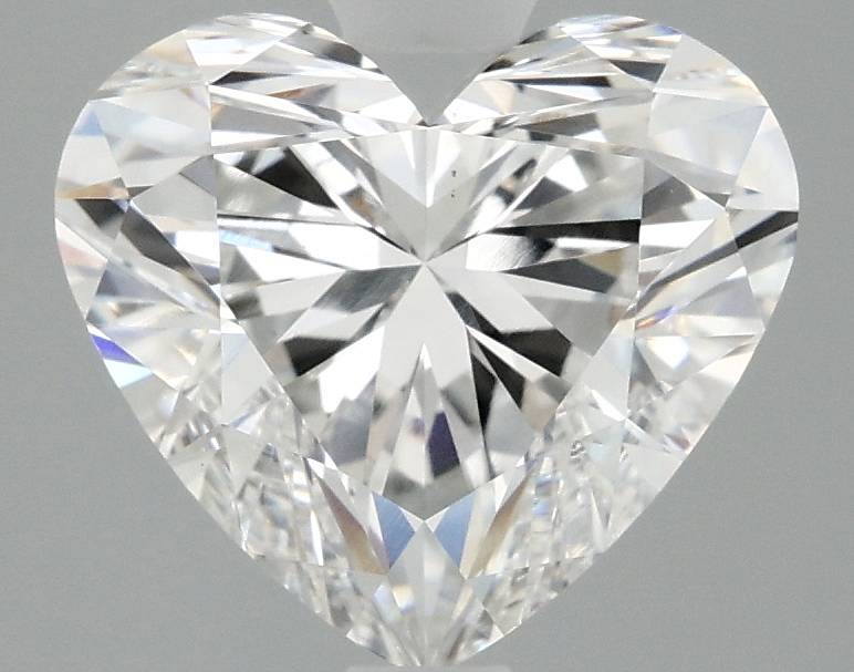 3.10 CT Heart Diamond