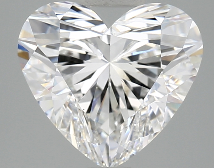 3.10 CT Heart Diamond